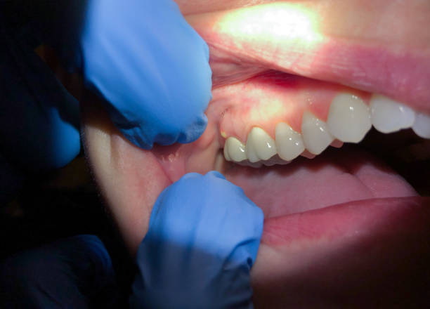 Best Walk-In Emergency Dentist in Piney Green, NC