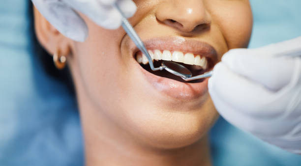 Best Emergency Tooth Extraction in Piney Green, NC
